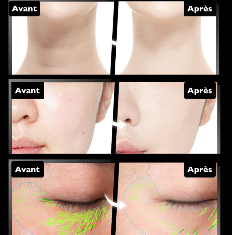 Ninalo™ - Masajeador sónico vibratorio lifting y reafirmante